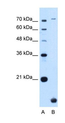TMEM91 antibody