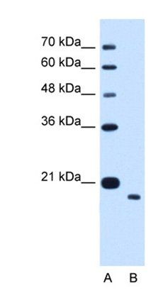 TMEM91 antibody