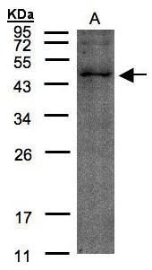 TMLHE antibody [N2C3]