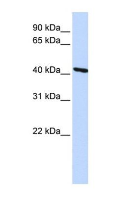 TMOD3 antibody