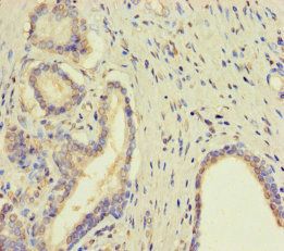 TMPRSS11D Antibody