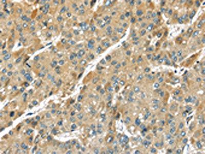 TMPRSS11D Antibody