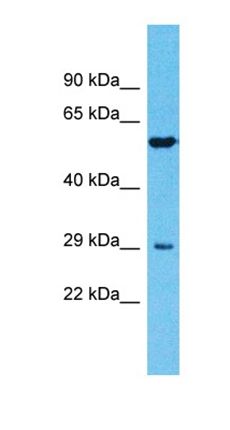 TMPRSS11E antibody