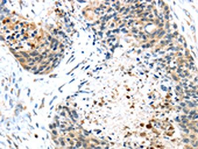 TMPRSS4 Antibody