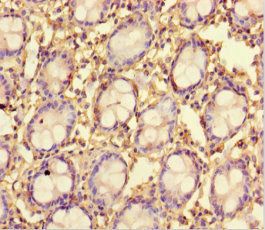 TMPRSS7 Antibody