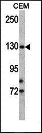 TMPRSS9 antibody