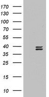 TMS1 (PYCARD) antibody