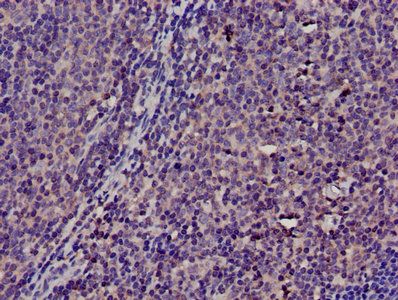 TMSB4X Antibody