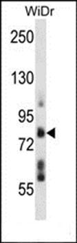 TMTC4 antibody