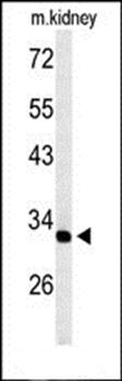 TMUB2 antibody