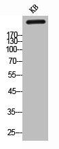 TNC antibody