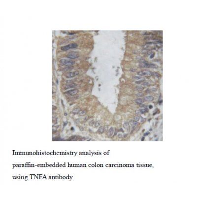 TNF alpha antibody