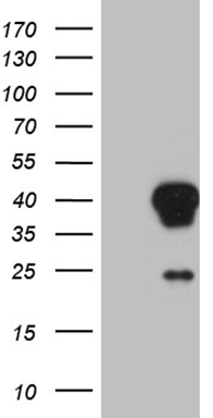 TNF alpha (TNF) antibody