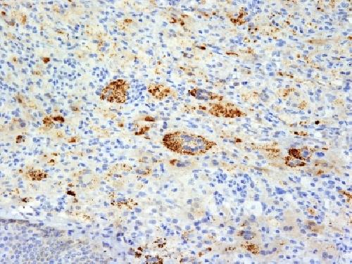 TNF Antibody