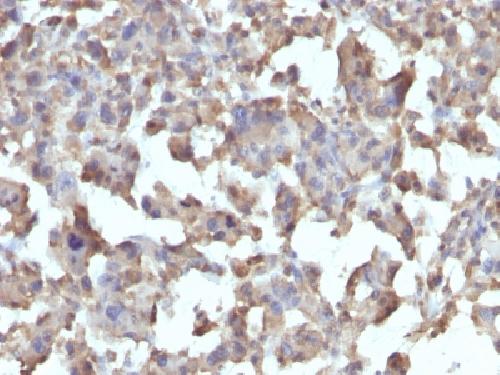 TNF Antibody