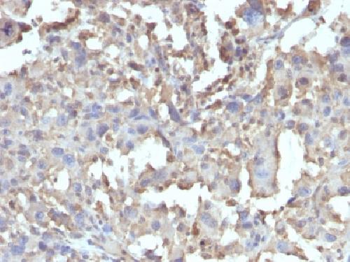 Recombinant TNF-alpha (Tumor Necrosis Factor alpha) Antibody