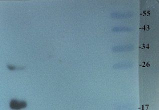 TNF alpha antibody