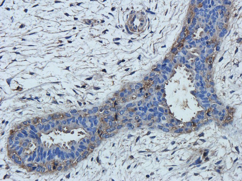 TNF alpha antibody