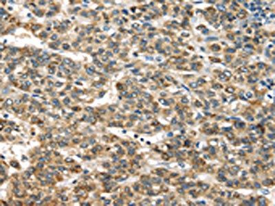 TNFAIP2 Antibody