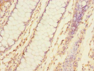 TNFAIP8 Antibody