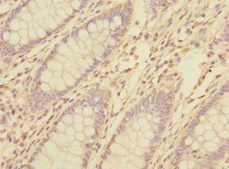 TNFAIP8 Antibody