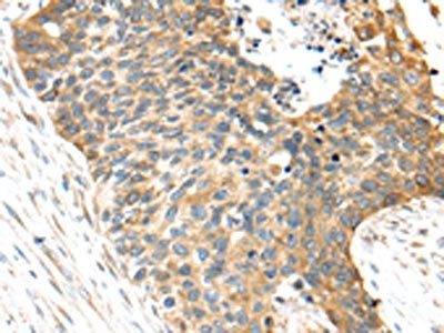 TNFAIP8 Antibody
