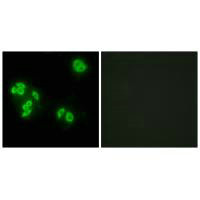 TNFAIP8 Antibody