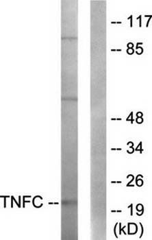 TNFC antibody
