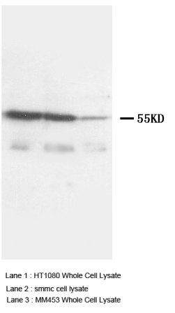 TNF Receptor I/TNFRSF1A Antibody