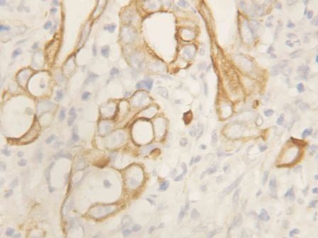 Anti-TNF Receptor II/TNFRSF1B Antibody