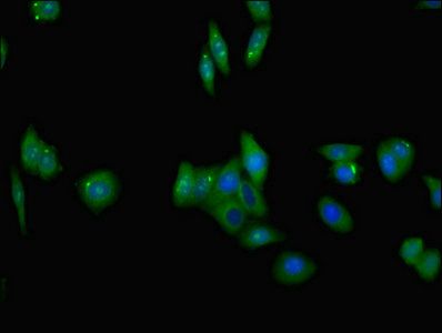 TNFRSF10C Antibody
