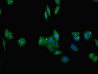 TNFRSF10C antibody