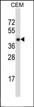 TNFRSF10D antibody