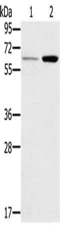 TNFRSF11A antibody