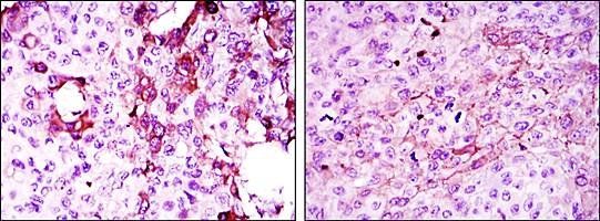 TNFRSF11B Antibody