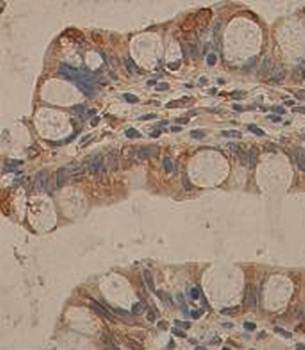 TNFRSF12 Rabbit Polyclonal Antibody
