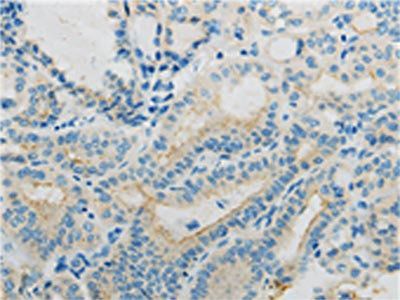 TNFRSF12A antibody