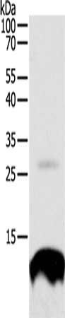 TNFRSF12A antibody