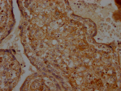 TNFRSF12A Recombinant Monoclonal Antibody