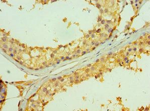TNFRSF13B Antibody