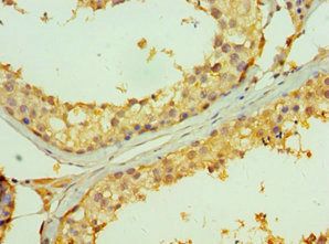 TNFRSF13B antibody