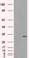 TNFRSF14 antibody