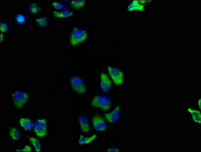 TNFRSF1A antibody