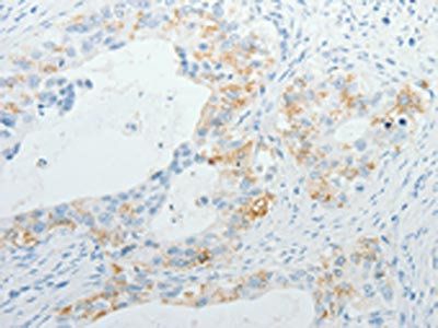 TNFRSF1B antibody