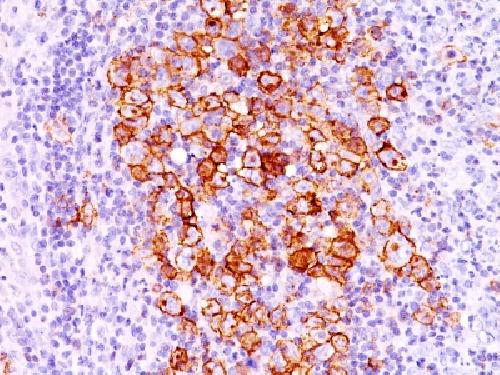 TNFRSF8 Antibody