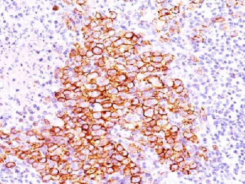 TNFRSF8 Antibody