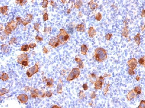 Recombinant CD30 / TNFRSF8 (Hodgkin & Reed-Sternberg Cell Marker) Antibody