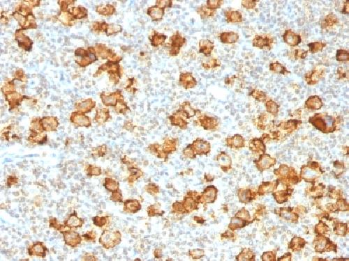 Recombinant CD30 / TNFRSF8 (Hodgkin & Reed-Sternberg Cell Marker) Antibody