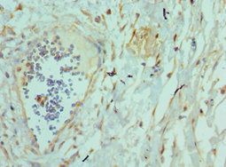 TNFSF12 antibody