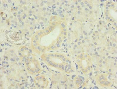 TNFSF12 antibody